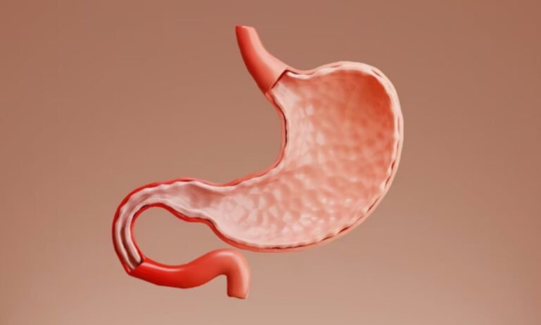 Cholerhiasis Explained: What It Really Means and Why It Matters